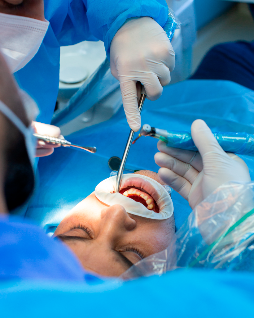 Maxilofacial